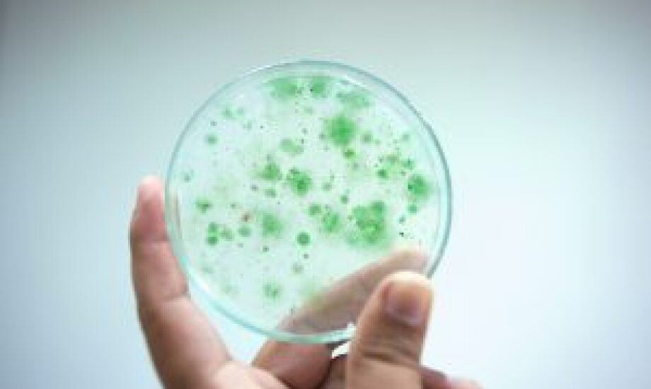 bacteria