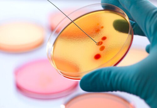 scientist collecting a sample from a petri dish