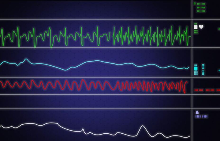 Various line graphs showing a patient's vital signs