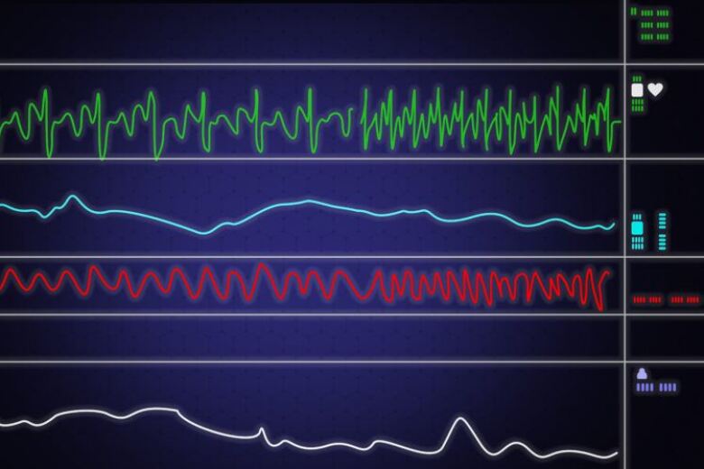 monitor showing patient vital signs