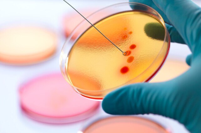 scientist collecting a sample from a petri dish