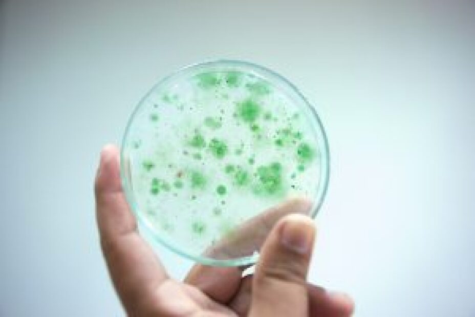 bacteria